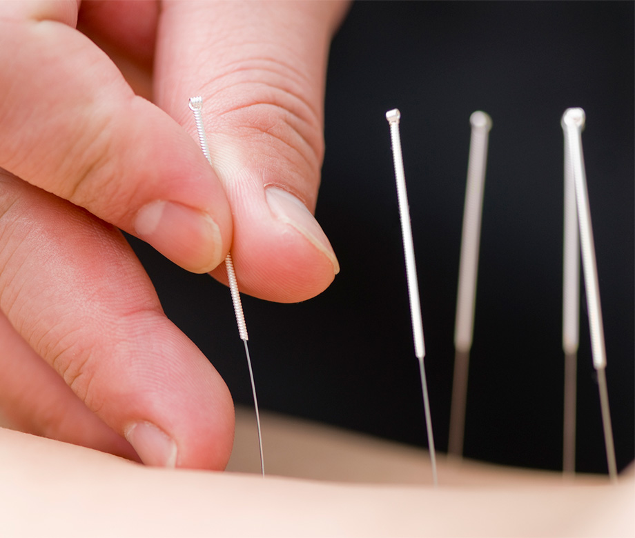 Behandlung mit Akupunktur zur Stärkung der Lebensenergie | Heilpraktiker Volkher Albrecht